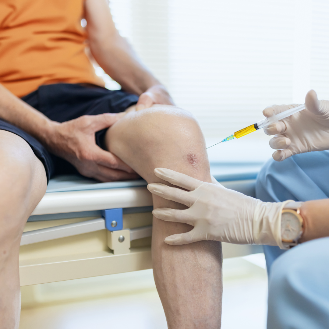 PRP Therapy